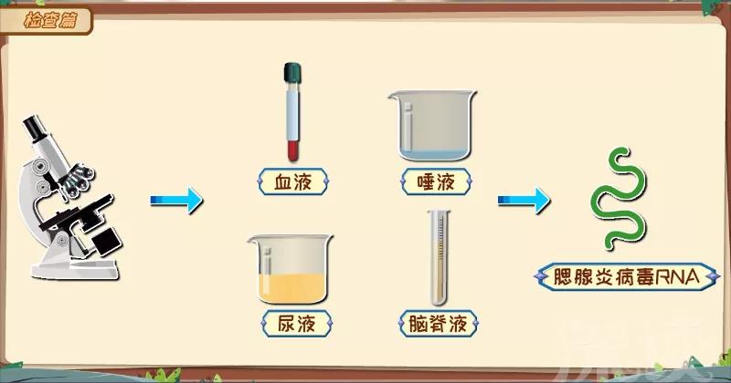 腮腺炎浑身疼怎么快速止疼,腮腺炎肿痛怎么办