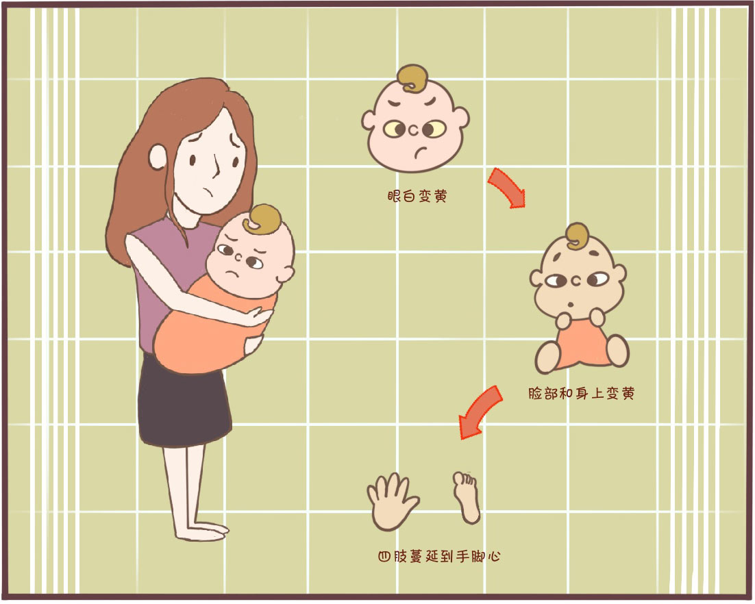 黄疸高晒太阳晒多久可以去除黄疸,生理性黄疸晒太阳黄疸下得快吗