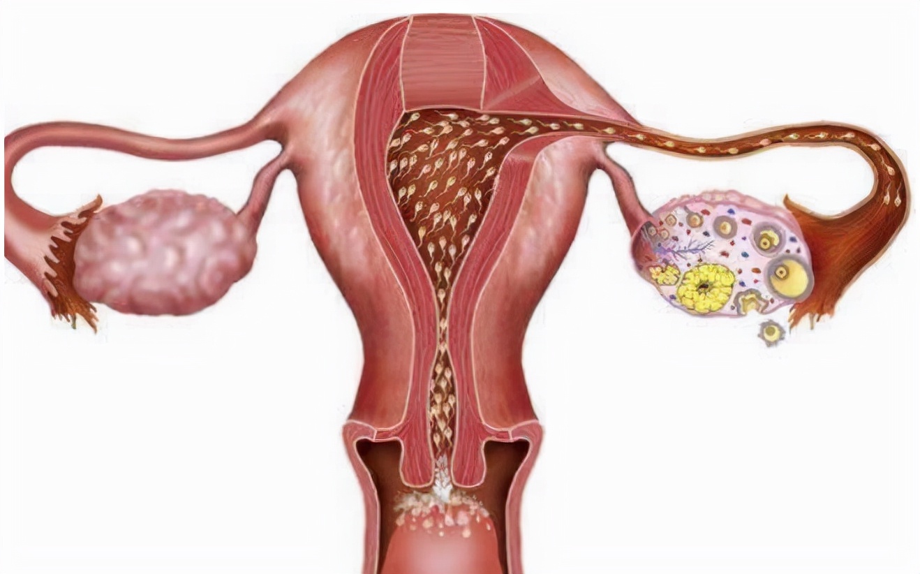 女性月经量少是什么预兆,女性月经量少是什么原因呢