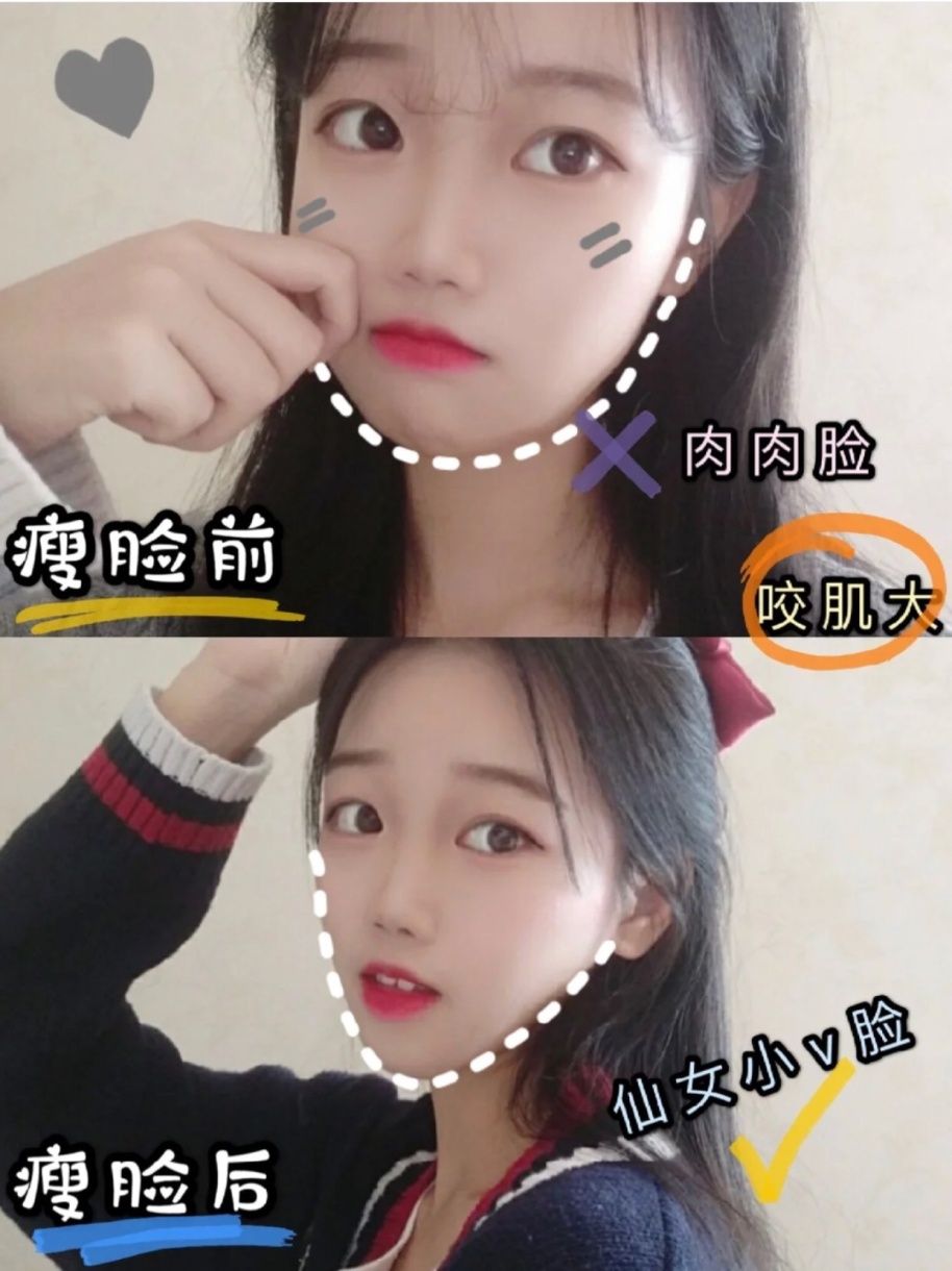 如何快速让圆脸瘦成小v脸,被别人说大脸妹