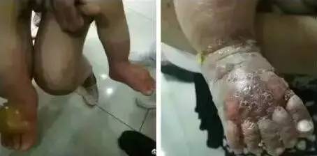 不要擅自给宝宝使用的14种药物,5个月宝宝服用神药