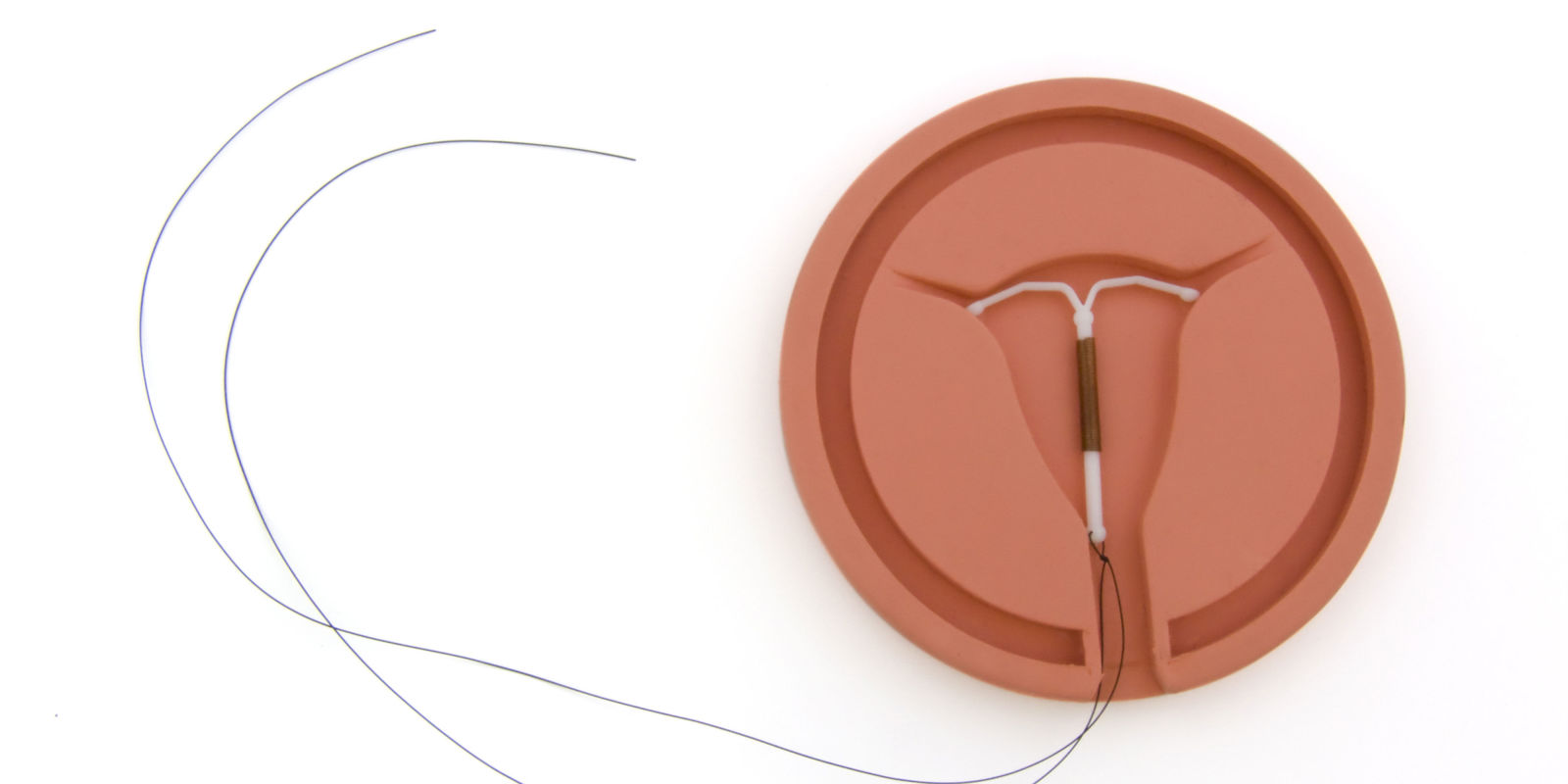 说到避孕，这9种方式最主流，你觉得哪个好？