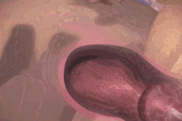 孕妇胎儿动图,3d动图视频怎么做