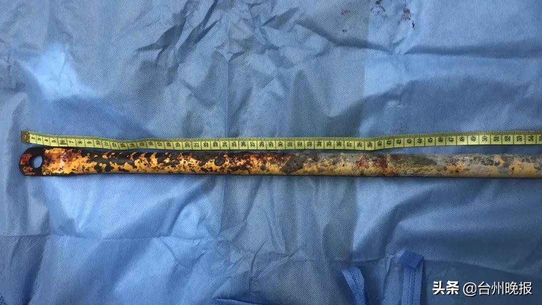 太吓人！台州男子高处跌落，钢管扎进身体32厘米，体外还留着1米长……