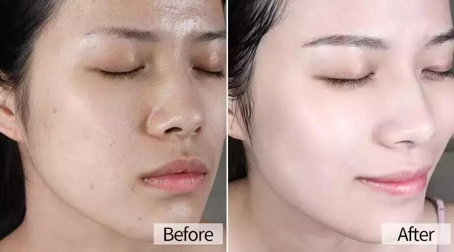 美丽新肌面膜,最全医美护肤面膜