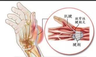 新手妈妈的烦恼完整版,新手妈妈的困惑期