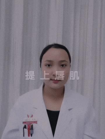 康复科面瘫手法,面瘫后遗症的康复训练