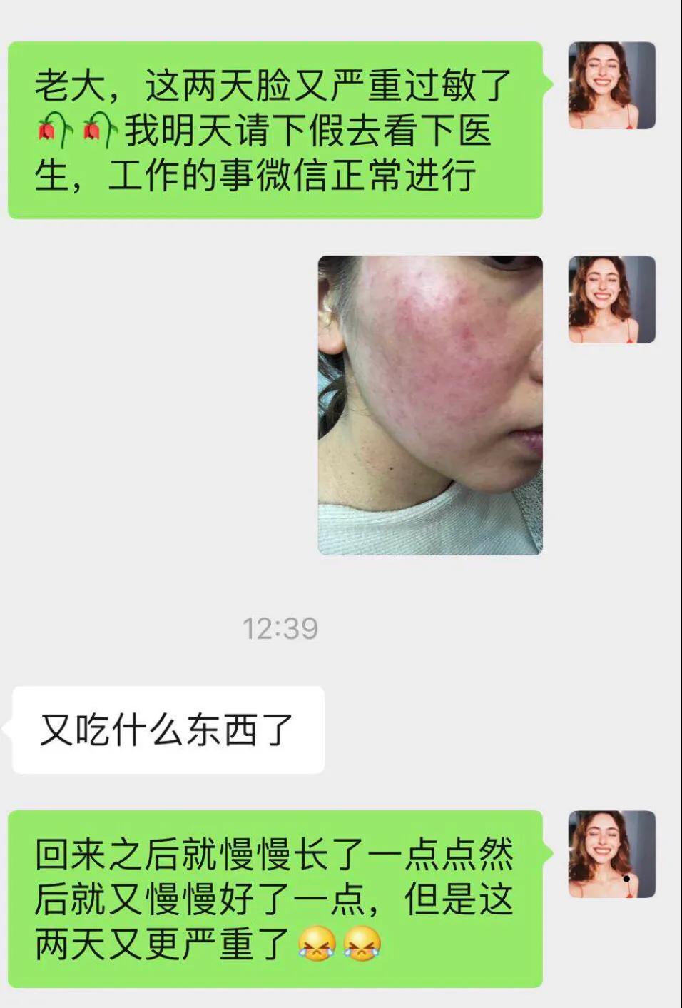 与病魔对抗的第30天,激素脸排毒第31天