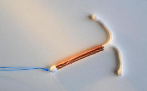 上环后月经会提前或者延后吗,上环后月经推迟一周会不会怀孕