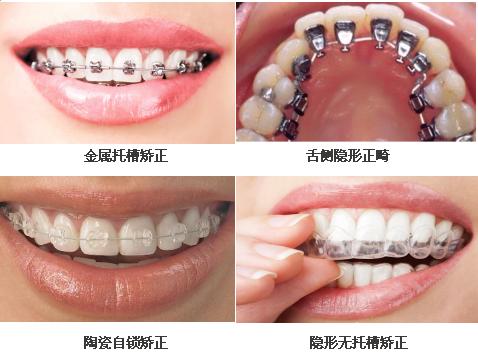 幼儿牙齿咬合不齐怎么办,正畸结束后牙齿咬合不齐
