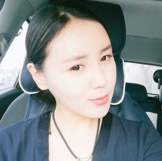 额头扁平怎么填充自然好看,额头颞部怎么填充好看