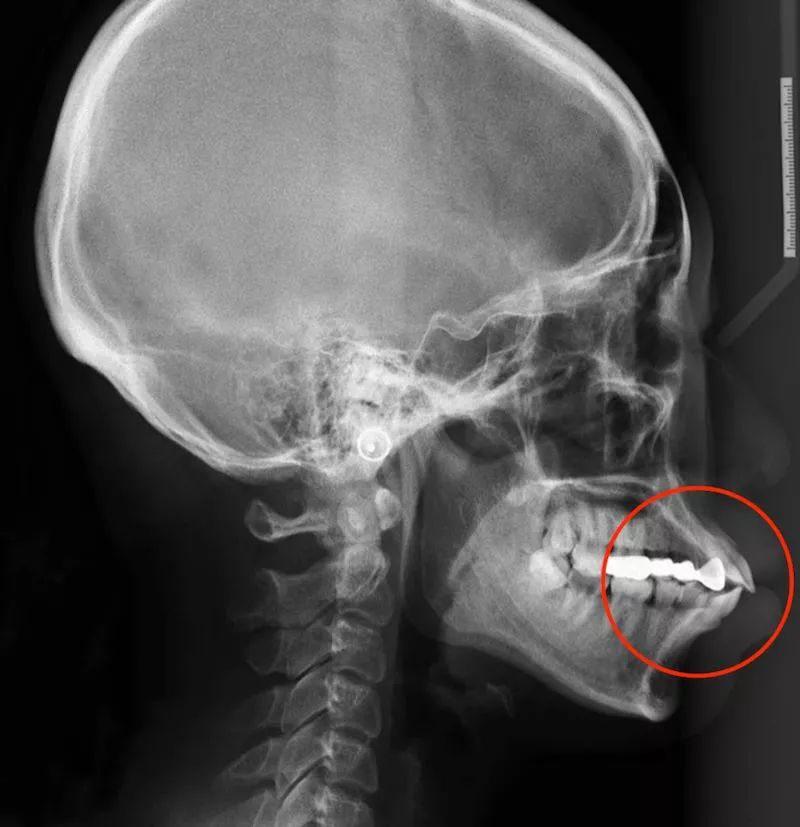 被颜值耽误的嘴,被嘴耽误颜值