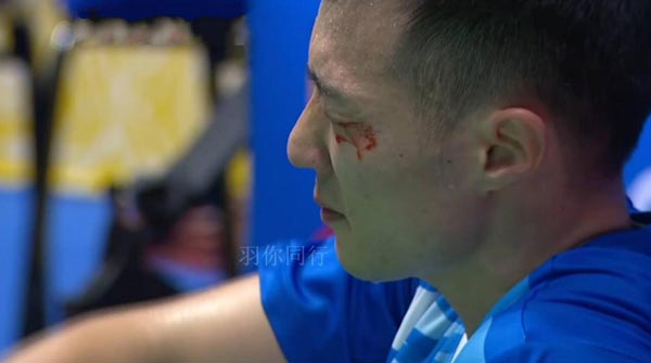 打球近视佩戴什么眼镜好,近视者选眼镜