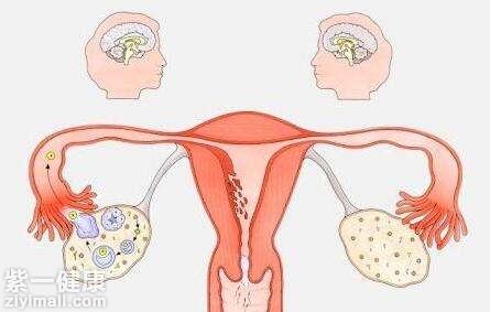 疾病认知：女性健康要注意-崩漏