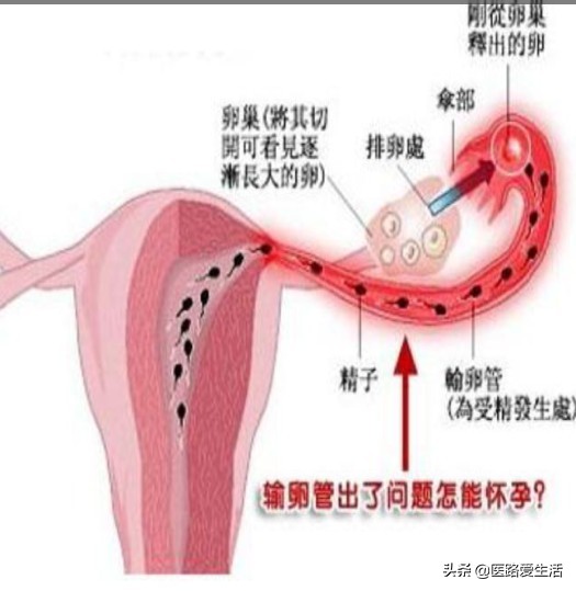 女人不孕不育十大原因,女人不孕不育祖传秘方