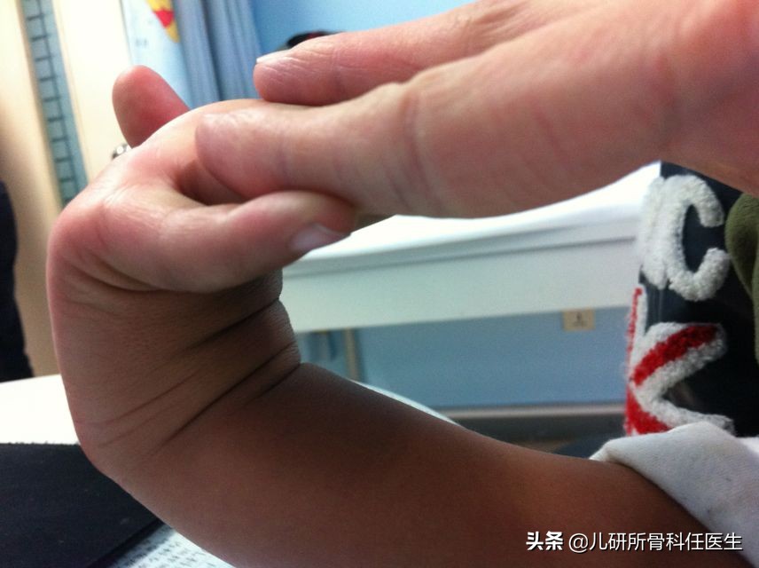 孩子出门玩耍担心牵拉肘？爸爸妈妈看这一篇就够了