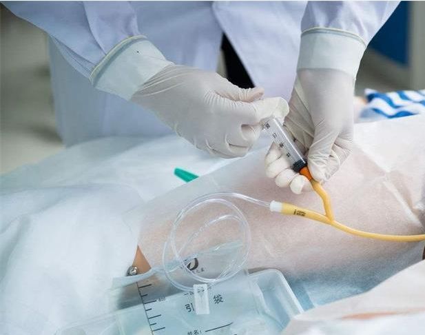 导尿管出院护理记录,留置尿管尿道口护理操作流程