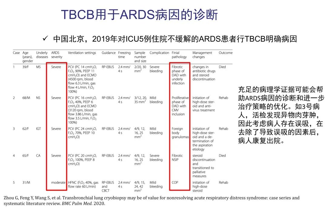经皮肺穿刺活检术过程,经支气管冷冻肺活检