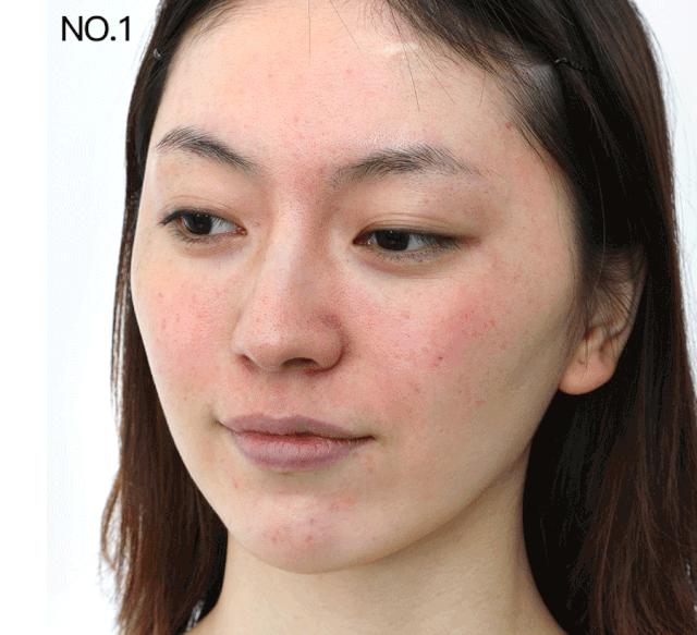 sk2适合敏感肌肤用吗,敏感肌能用sk2小白瓶