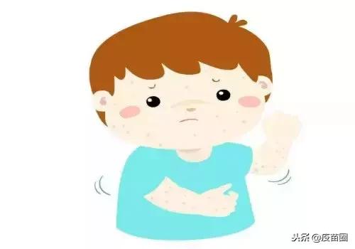 水痘高发期间谨记战痘三大招,水痘高发期战痘防护要做好