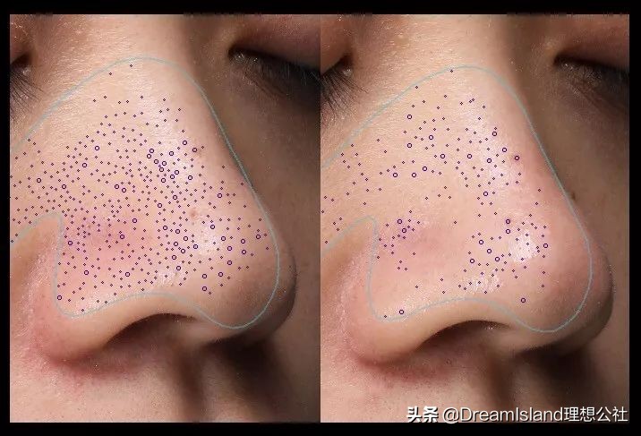 如何从根本上解决黑头问题,黑头太顽固教你去黑头的方法