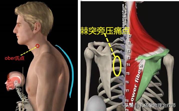 肩颈颈椎痛怎么缓解最快最有效,颈椎病最怕的5个症状