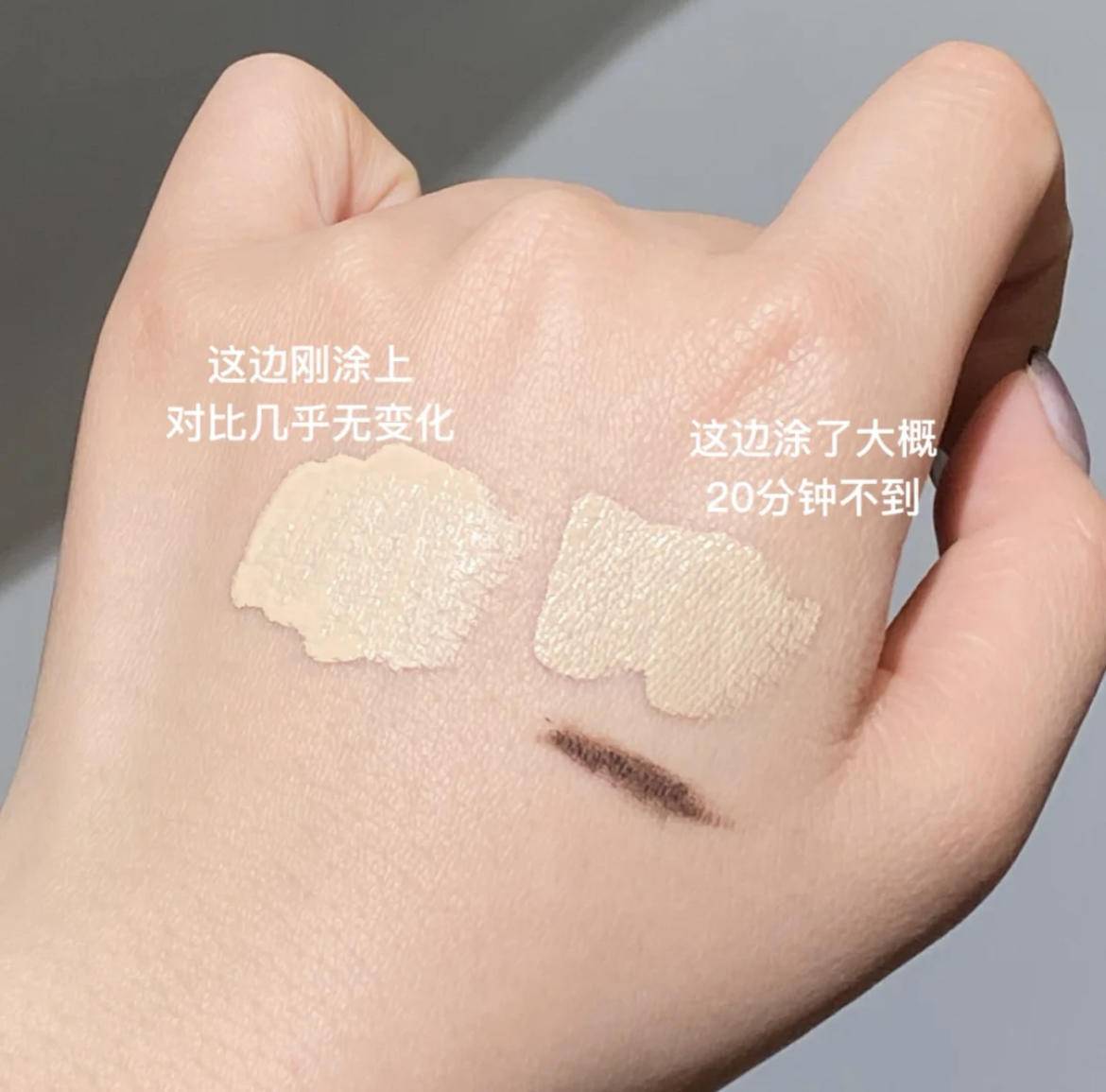 严重泪沟黑眼圈,淡化黑眼圈和泪沟原理