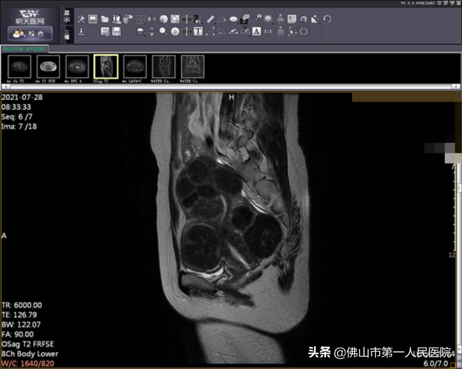 这把“刀”能隔山打“牛”,呵护子宫,带来好“孕”