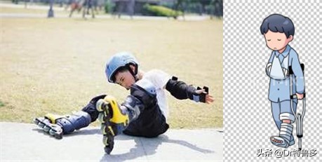 骨折了不长、长得慢怎么办？试试冲击波治疗吧