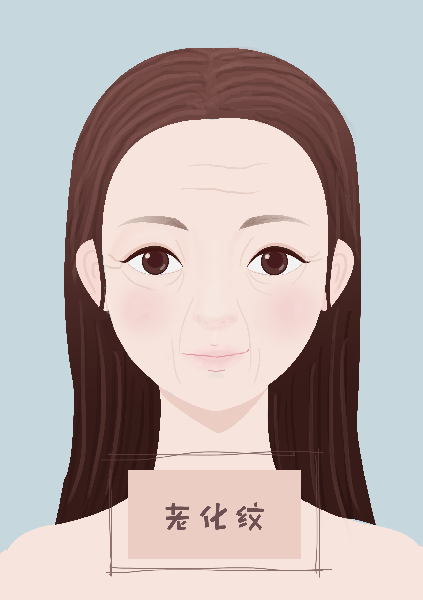 30脸上开始长细纹了怎么办,脸上下垂细纹松弛