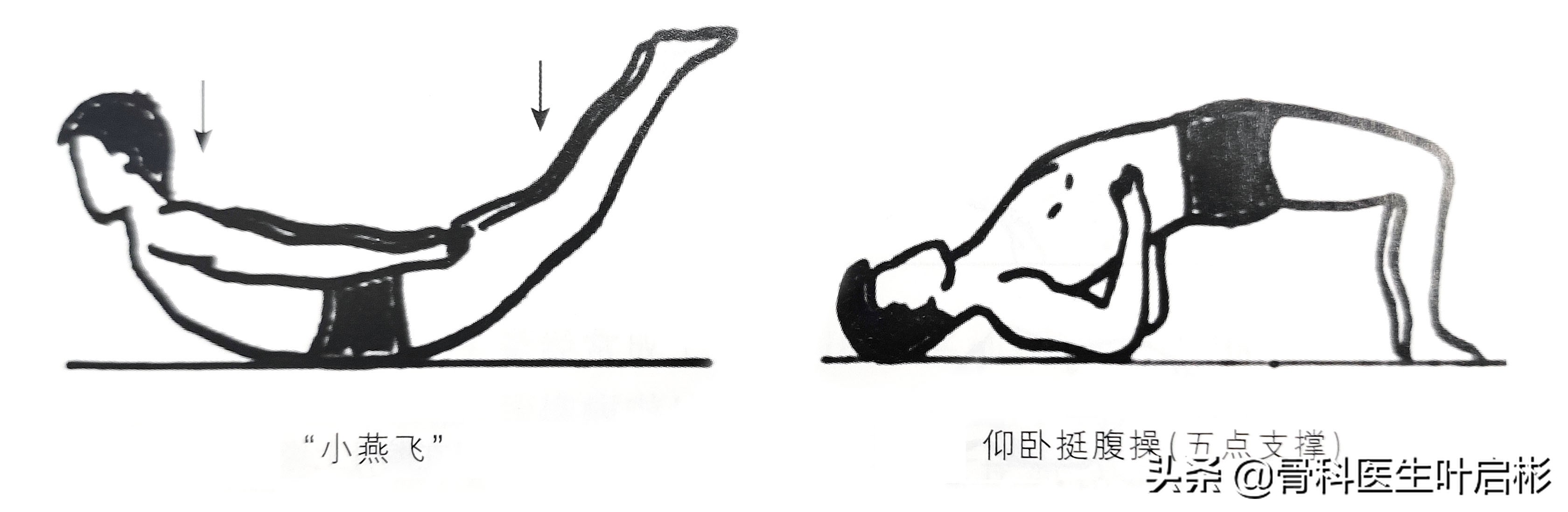 治疗腰背酸痛的养生方法,治疗腰背疼的训练