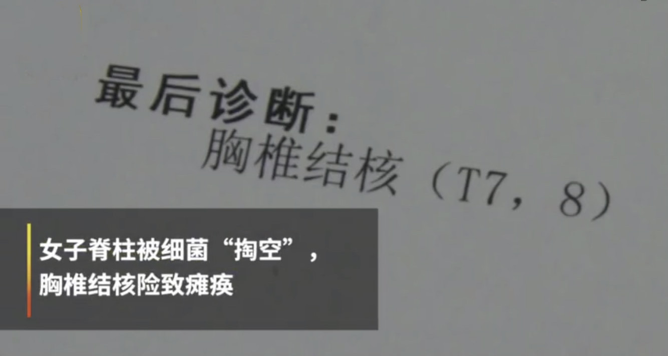 腰背疼痛当心骨质疏松,腰背痛或是骨质疏松