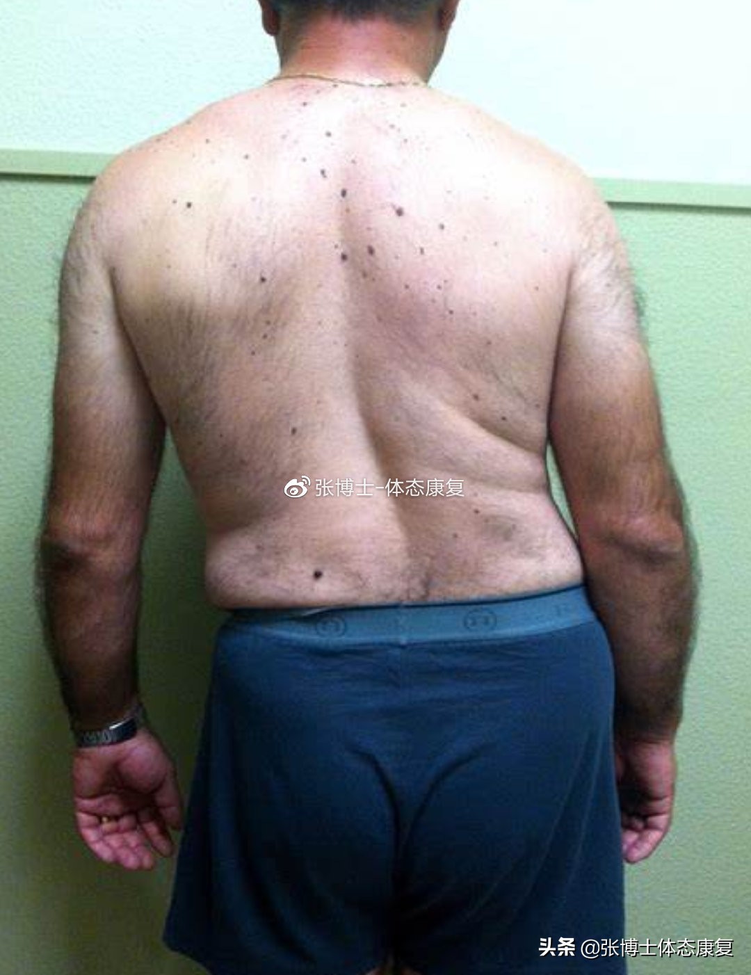 体态矫正拉伸训练,腰方肌拉伸骨盆