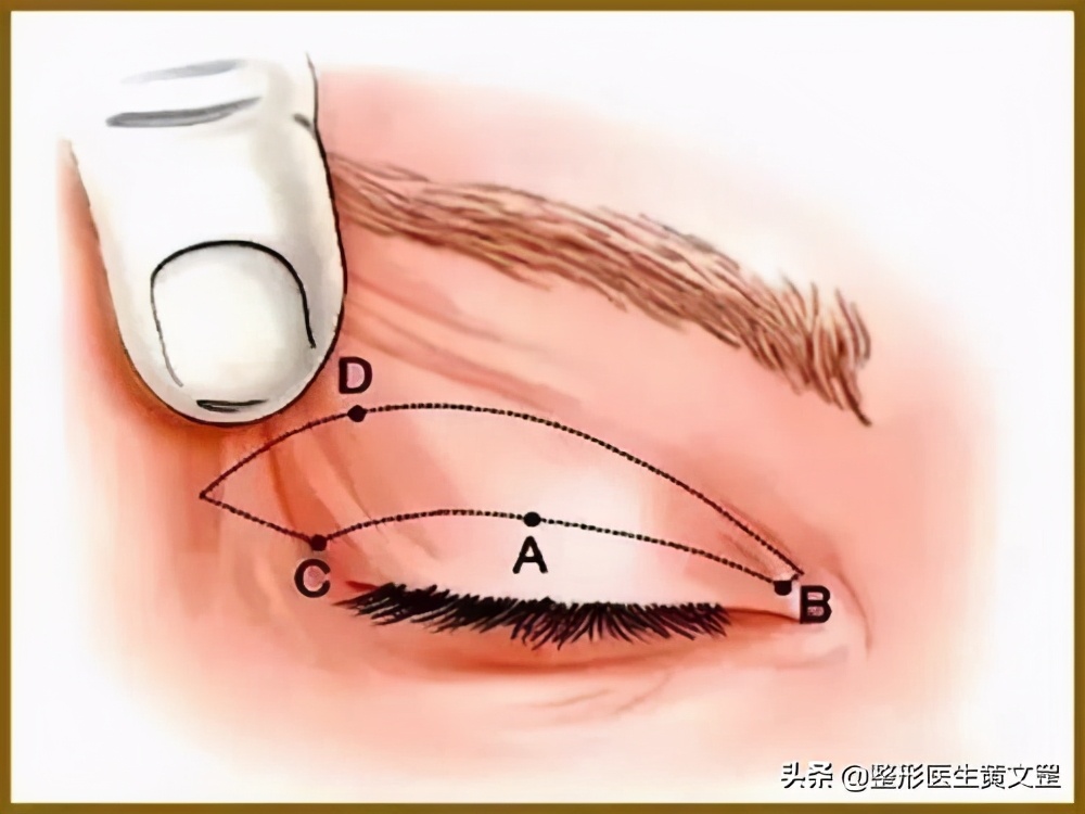 黑眼珠一定是圆吗,黑眼珠全部露出来眼睛大吗