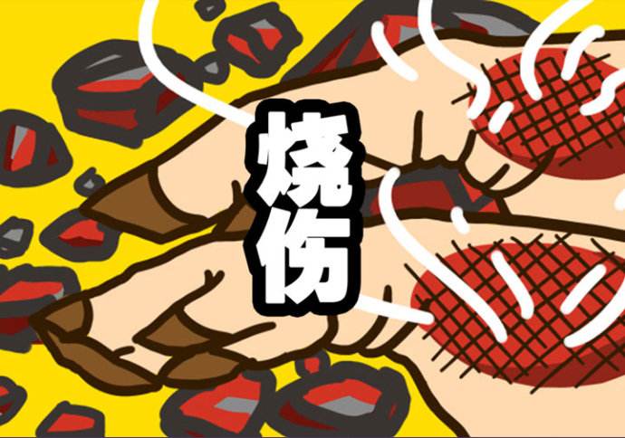 烧伤处理方法包扎,烧伤时正确的急救方法