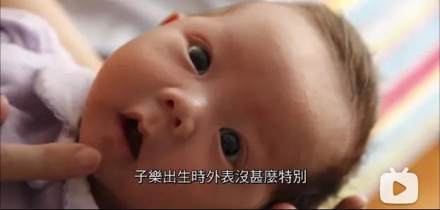 “幼儿看病4天花55万”上热搜，很多患了罕见病的孩子，无药可医