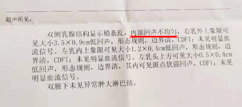 乳腺结构紊乱回声不均是什么意思,乳腺报告回声欠均匀是什么意思