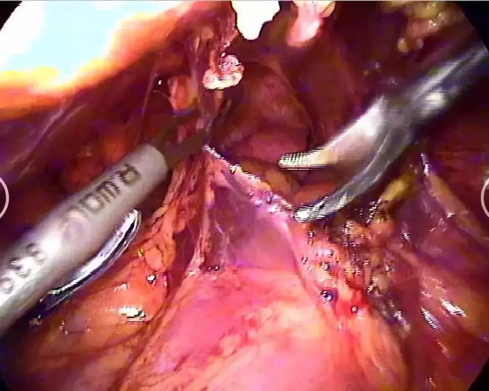 赵丽颖产子后现状,赵丽颖哪年产子