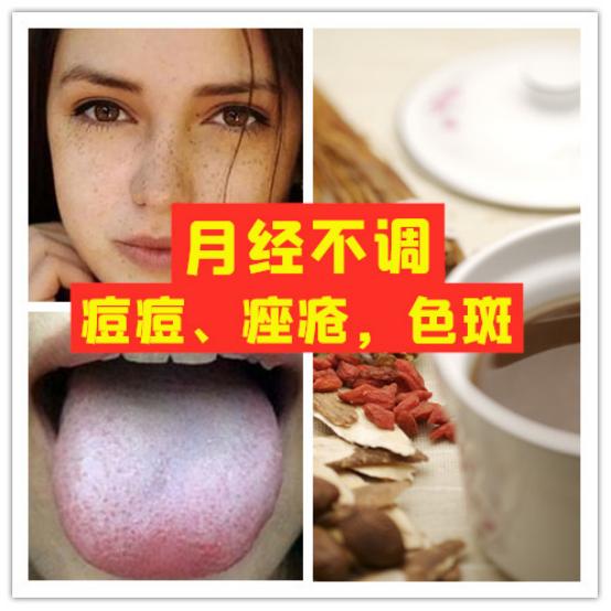 经期量少黑褐色怎么调理,月经褐色量少中药可以调理吗