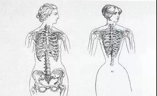 “内脏下垂、子宫脱落、漏尿”：扒一扒你不知道的网红束腰