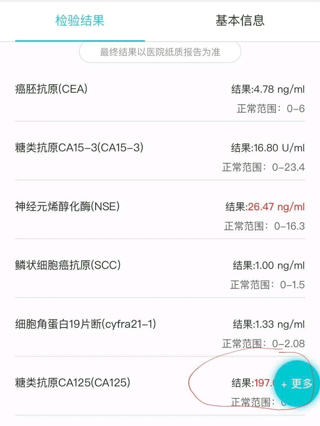 刘懿博士肺癌术后复查,肺癌检测肿瘤五项只有ca125偏高