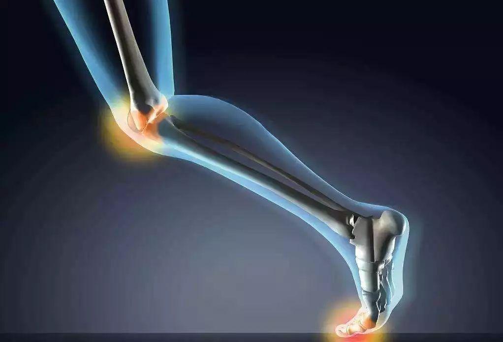 骨肉瘤全身关节疼痛,骨肉瘤的早期的疼痛特点