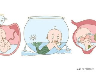 空腹做b超说羊水少,B超显示羊水少但胎心正常