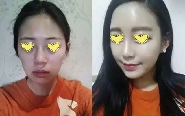 angelababy的容貌变化,angelababy变美过程