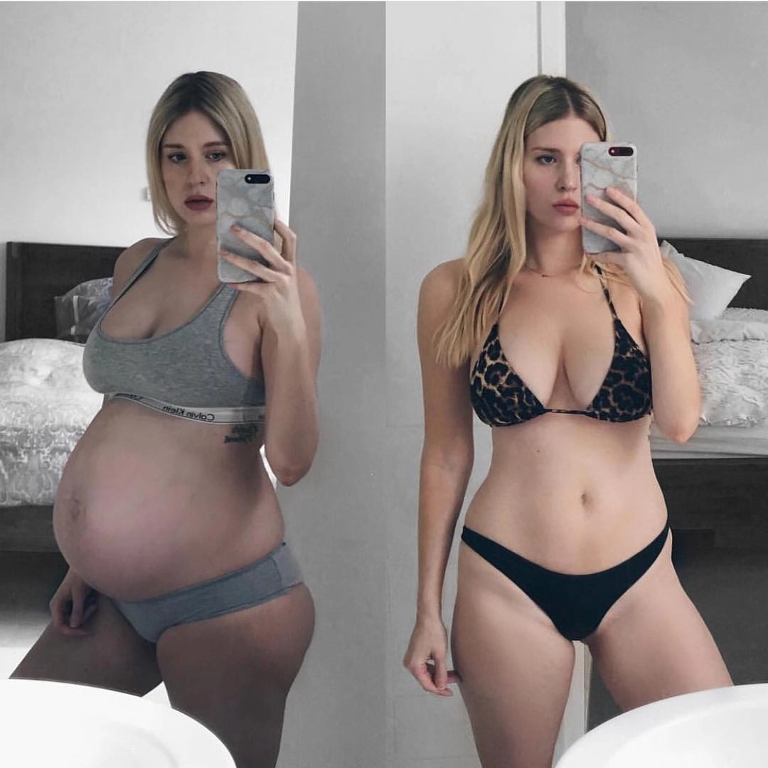 怎么预防妊娠纹的发生,妊娠纹越长越多赶紧试试这个方法