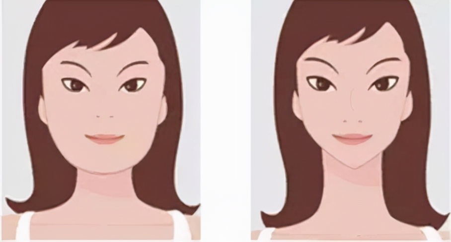 打完瘦脸针得注意什么,打完瘦脸针根本不需要忌口