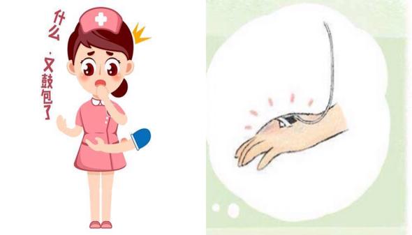 输液鼓包了疼怎么办,输液时鼓包了可以揉吗