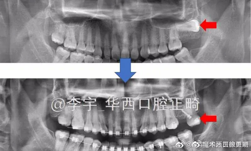 铜川乡*党**，矫牙前，请一字不漏读完这篇！