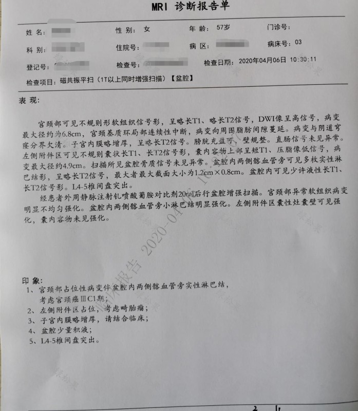 57岁患者绝经七年后出现阴道出血，原因竟是患上宫颈癌