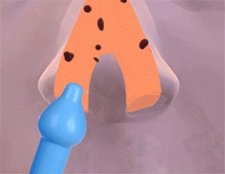 宝宝鼻塞流鼻涕可以用什么煮水喝,宝宝鼻塞流鼻涕用什么泡药浴